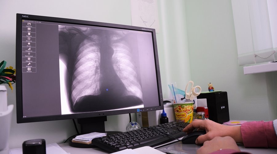 Количество госпитализированных с пневмониями крымчан выросло за неделю почти в 2,5 раза
