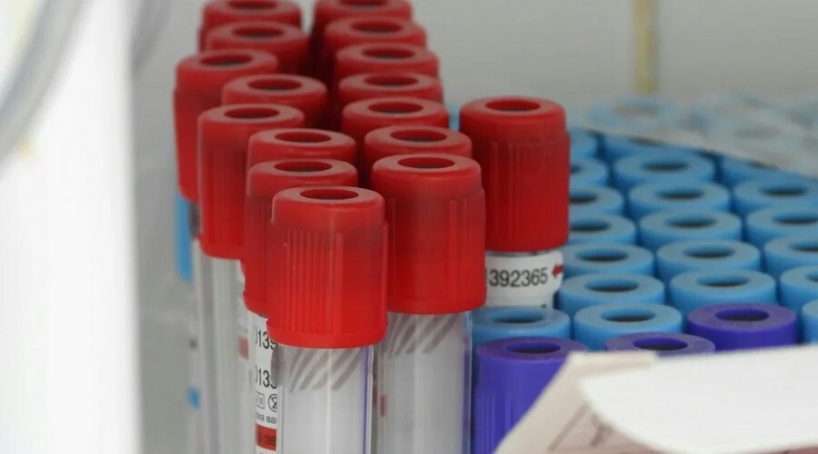 В Севастополе снова антирекорд по суточной заболеваемости COVID-19