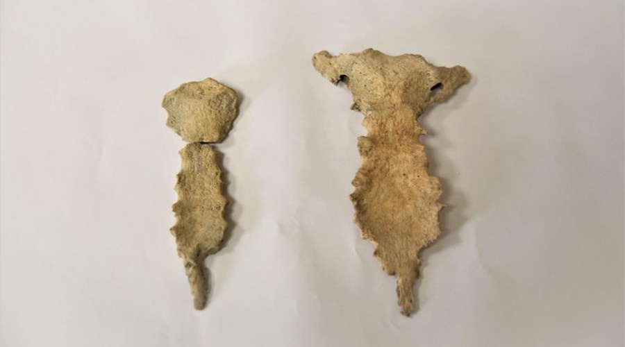 Археологи нашли в Херсонесе останки средневекового человека с редким генетическим заболеванием