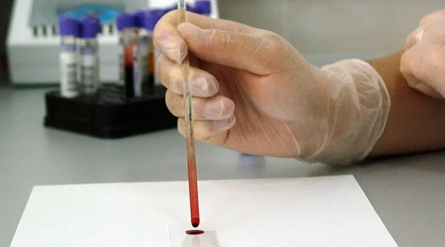 Крымский Центр крови передал медучреждениям полтонны антиковидной плазмы с начала пандемии