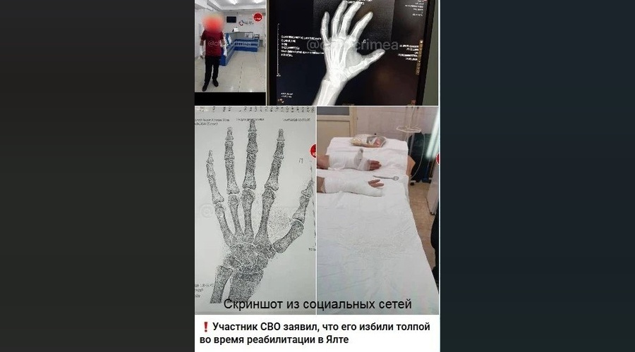 В Ялте полиция выясняет обстоятельства конфликта с участием нескольких человек