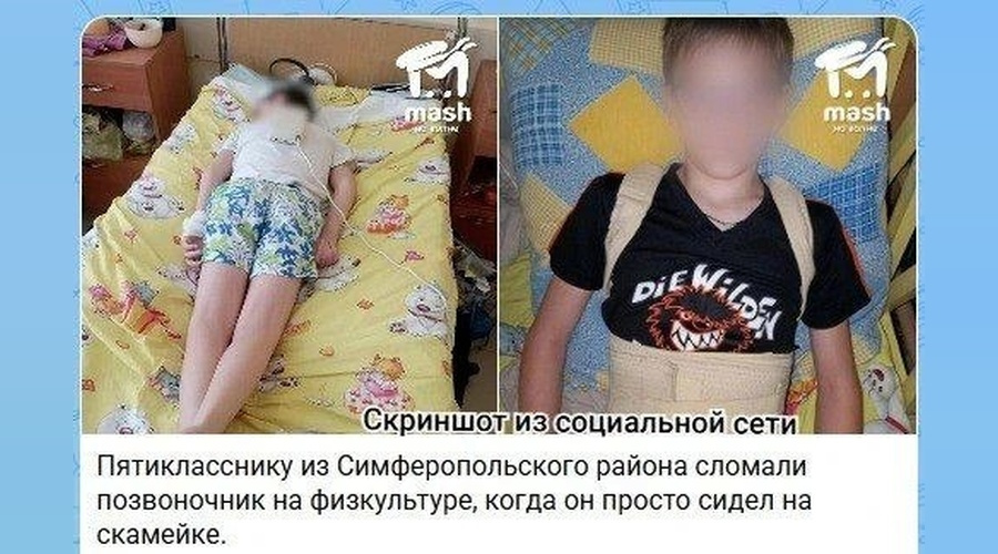 Полиция проверяет сообщение о травме 12-летнего школьника на уроке физкультуры